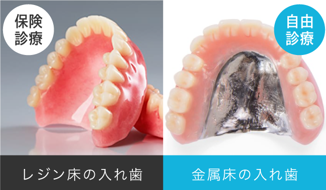 保険診療と自由診療の入れ歯の違い