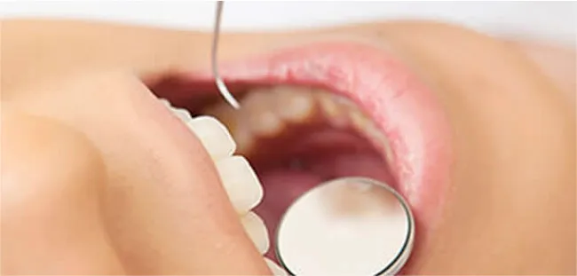 痛くない 怖くない虫歯治療 西宮 香櫨園 打出 むらまつ歯科