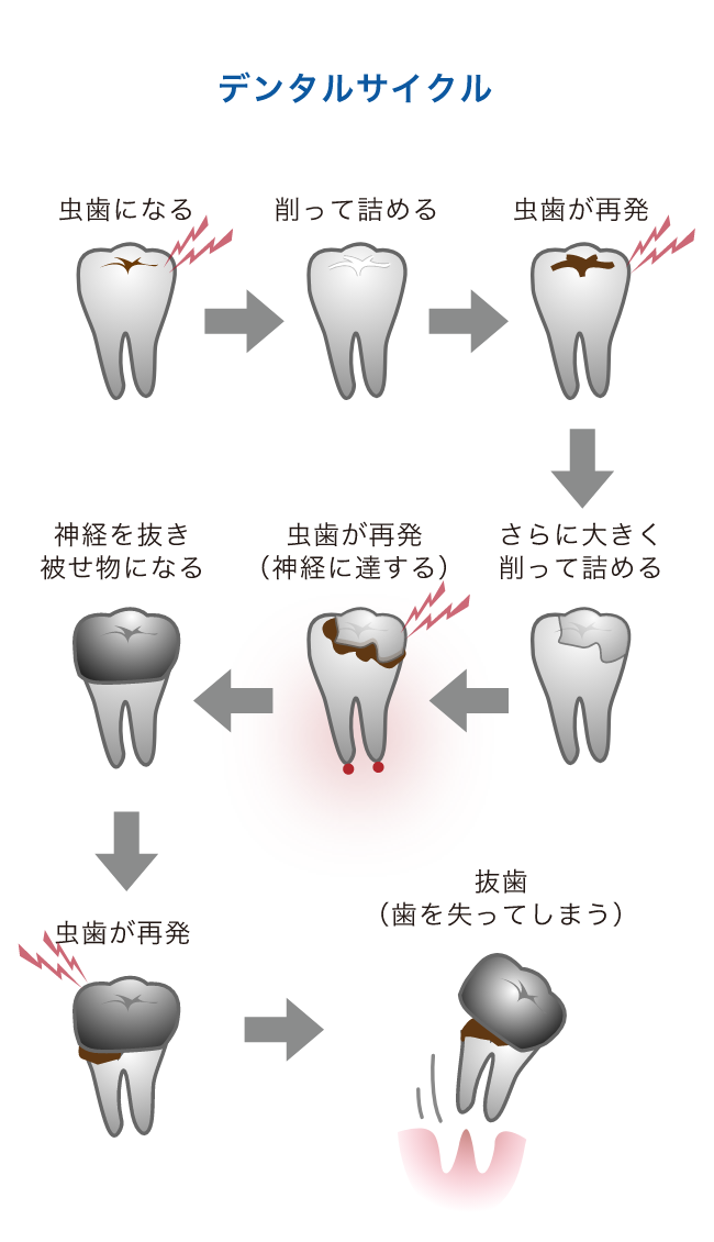 デンタルサイクル