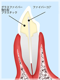 ファイバーコア