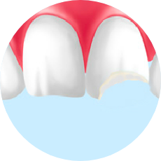 歯や口腔内のケガや外傷